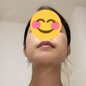 RG整形外科（旧リオン整形外科）口コミ