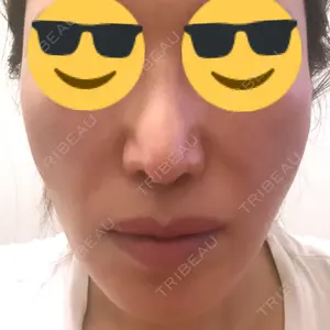 スノウ（Snow）整形外科口コミ