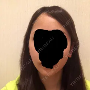 ボンディ美容整形外科（旧リオン整形外科）口コミ