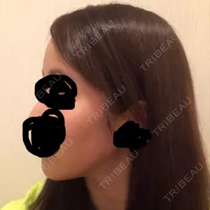 ボンディ美容整形外科（旧リオン整形外科）口コミ