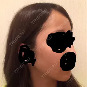 ボンディ美容整形外科（旧リオン整形外科）口コミ