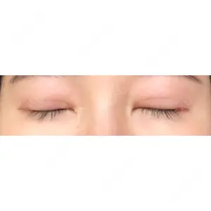 プロミス整形外科口コミ