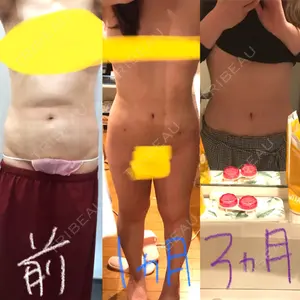 狎鴎亭トップライン医院口コミ