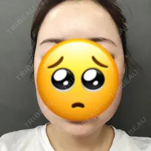 TCB東京中央美容外科 TCB東京中央美容外科 中野院口コミ