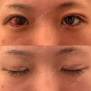湘南美容クリニック 湘南美容クリニック 松山院口コミ