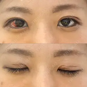 湘南美容クリニック 湘南美容クリニック 松山院口コミ