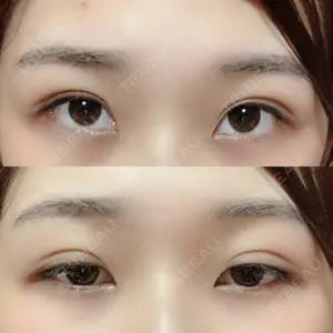 湘南美容クリニック 湘南美容クリニック 柏院口コミ