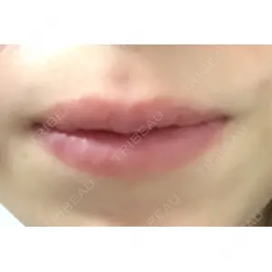 B-LINE CLINIC B-LINE CLINIC 池袋院口コミ