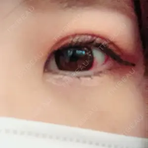 TCB東京中央美容外科 TCB東京中央美容外科 中野院口コミ