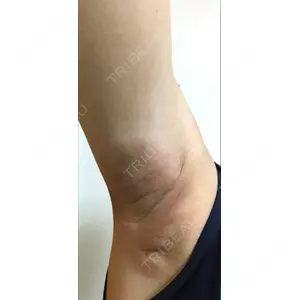 プレシャスクリニック自由が丘口コミ