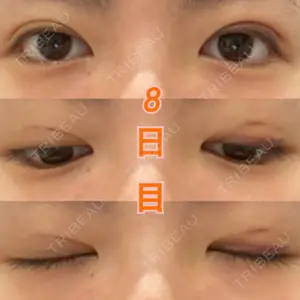 湘南美容クリニック 湘南美容クリニック 東京蒲田院口コミ