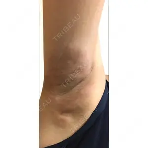 プレシャスクリニック自由が丘口コミ