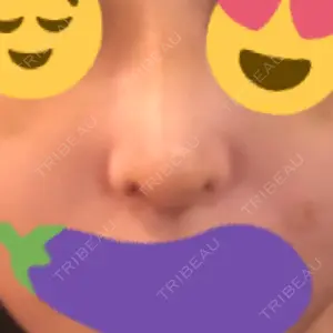 HANABI整形外科口コミ