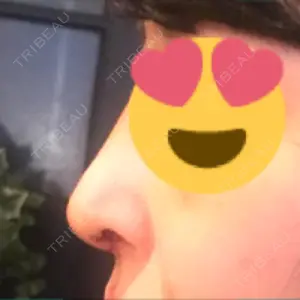 HANABI整形外科口コミ