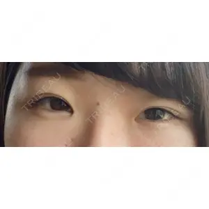 湘南美容クリニック 湘南美容クリニック 京都院口コミ