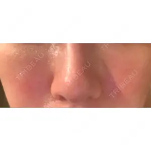 東京皮膚科・形成外科 東京皮膚科・形成外科 (銀座いけだクリニック)口コミ
