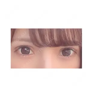 RG整形外科（旧リオン整形外科）口コミ