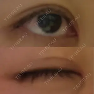 いちのせ形成外科・皮膚科 眼瞼＆フェイスクリニック口コミ