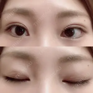 口コミ