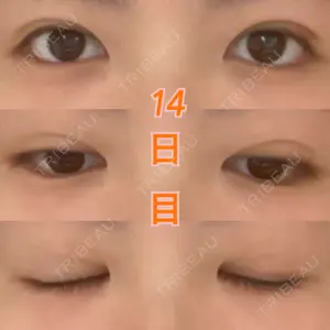 湘南美容クリニック 湘南美容クリニック 東京蒲田院口コミ