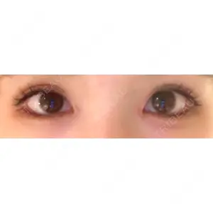 湘南美容クリニック 湘南美容クリニック 赤坂見附院口コミ