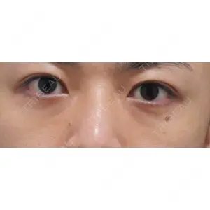東京イセアクリニック口コミ