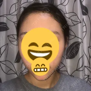 ボンディ美容整形外科（旧リオン整形外科）口コミ