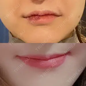 もとび美容外科クリニック 新宿院口コミ