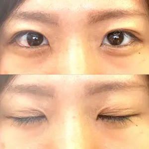 湘南美容クリニック 湘南美容クリニック 松山院口コミ