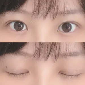 RG整形外科（旧リオン整形外科）口コミ