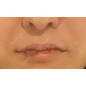 もとび美容外科クリニック 新宿院口コミ