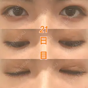 湘南美容クリニック 湘南美容クリニック 東京蒲田院口コミ