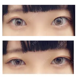 Lovelyan整形外科口コミ