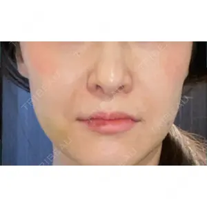 もとび美容外科クリニック 新宿院口コミ