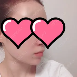 TCB東京中央美容外科 TCB東京中央美容外科 中野院口コミ