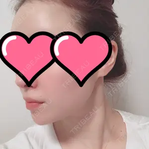 TCB東京中央美容外科 TCB東京中央美容外科 中野院口コミ