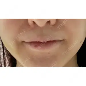 もとび美容外科クリニック 新宿院口コミ