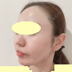 TCB東京中央美容外科 TCB東京中央美容外科 中野院口コミ