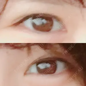 口コミ
