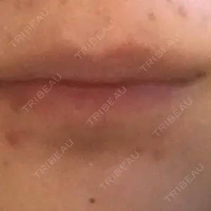 B-LINE CLINIC B-LINE CLINIC 池袋院口コミ