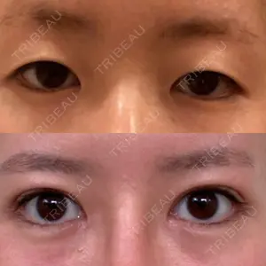 RG整形外科（旧リオン整形外科）口コミ