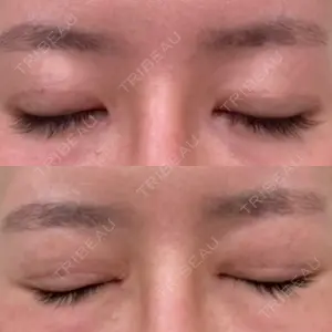 RG整形外科（旧リオン整形外科）口コミ