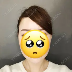 TCB東京中央美容外科 TCB東京中央美容外科 中野院口コミ