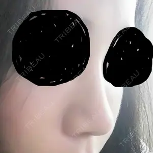 マーブル整形外科口コミ