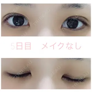 湘南美容クリニック 湘南美容クリニック 赤坂見附院口コミ