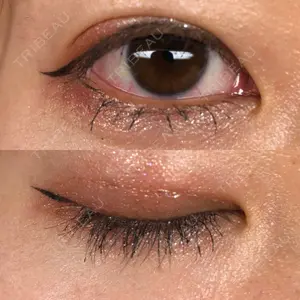 TCB東京中央美容外科 TCB東京中央美容外科 京都駅前院口コミ