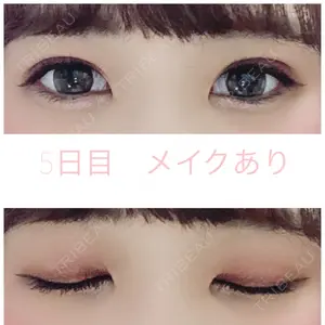 湘南美容クリニック 湘南美容クリニック 赤坂見附院口コミ