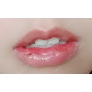 B-LINE CLINIC B-LINE CLINIC 池袋院口コミ