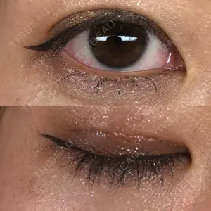 TCB東京中央美容外科 TCB東京中央美容外科 京都駅前院口コミ