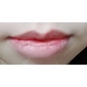 B-LINE CLINIC B-LINE CLINIC 池袋院口コミ